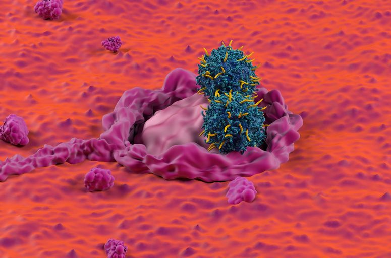 cáncer de colon